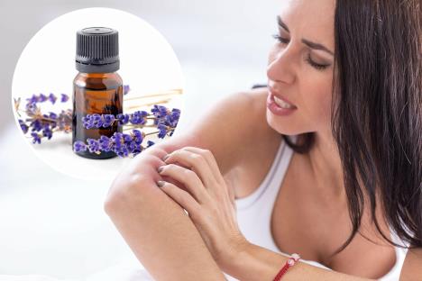 ujed komarca, lavanda, eterično ulje.jpg
