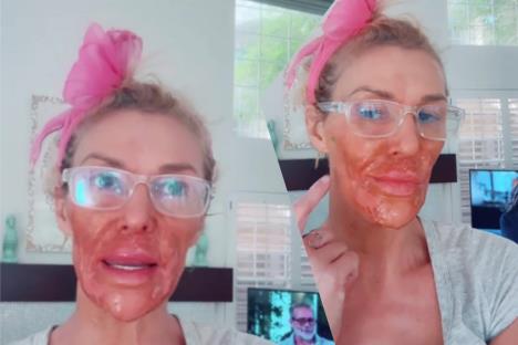 Brendi Glenvil spalila svoje lice kremom