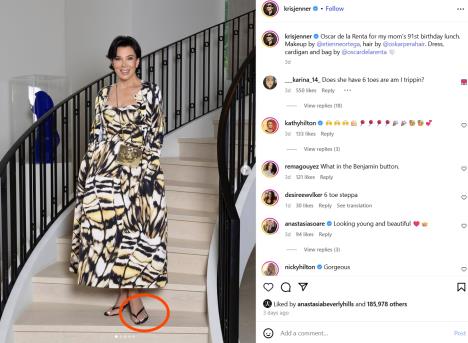 Kris Džener se zaigrala u fotošopu i ima 6 prstiju na nozi