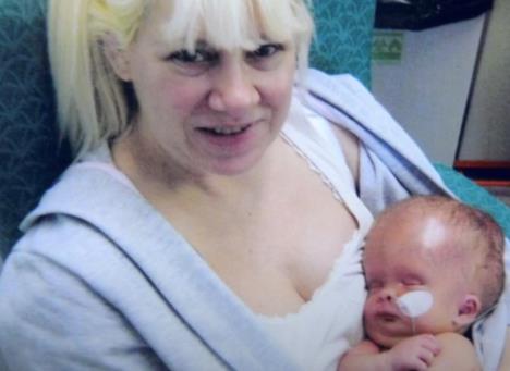 Noa Vol rođen sa 2% mozga, na rođenju imao veliku glavu