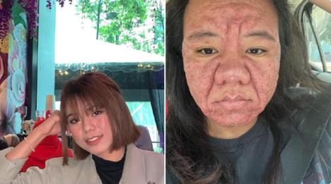 fara faizal problemi u trudnoći