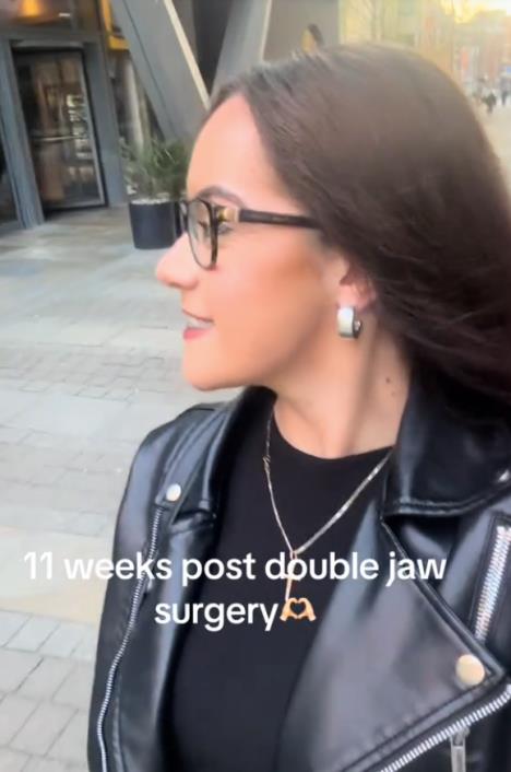 Luiza Mekdermot nakon operacije vilice