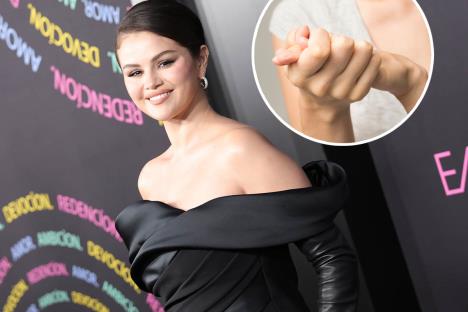 Selena Gomez lupus