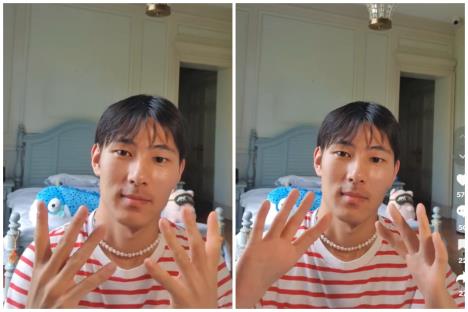 Ćao Albers je rođen bez palčeva