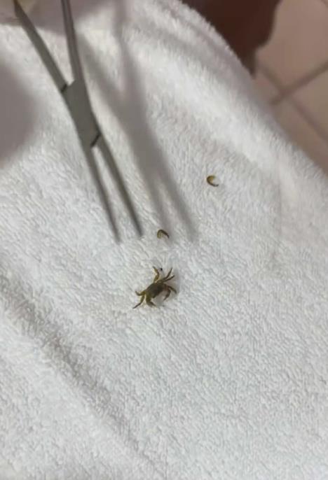 Dečaku se kraba zaglavila u uvetu