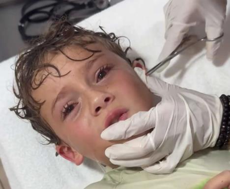 Dečaku se kraba zaglavila u uvetu