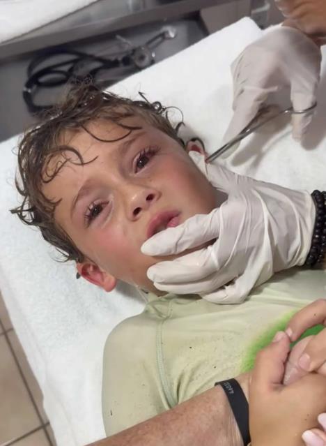 Dečaku se kraba zaglavila u uvetu