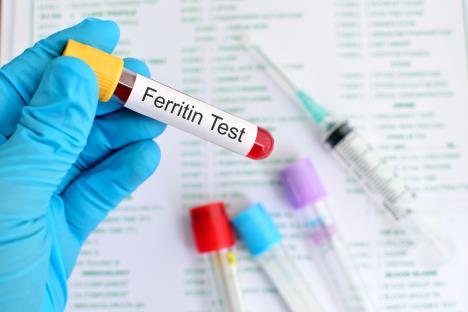 laborant drži epruvetu sa natpisom feritin test, koncept anemija