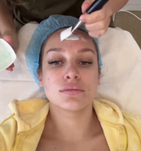 Luna Đogani na estetskoj korekciji