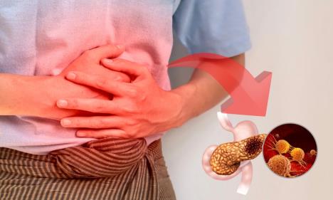 Čovek se drži za deo trbuha gde je žuč/Slikovit prikaz nakupljanja naslaga u žučnoj kesi