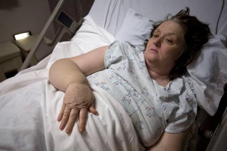 Žena leži u bolničkom krevetu