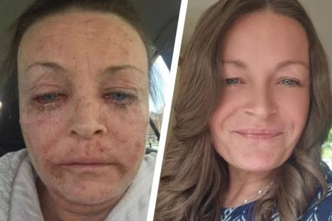 Ema Vord pre i posle alkoholizma.jpg