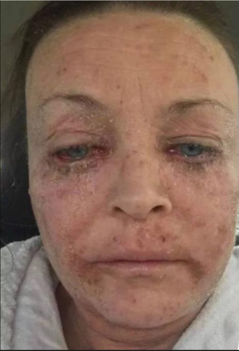 Ema Vord tokom borbe sa alkoholizmom.jpg