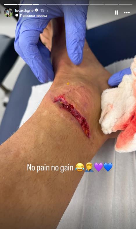 Jeziva povreda Luke Dinja