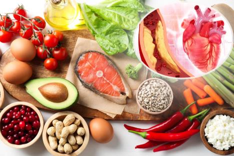 Zdrava hrana za dobre nivoe holesterola: avokado, jaja, riba, maslinovo ulje, paradajz, ljuta paprika/Nakupljanje masnoće u arteriji, srce