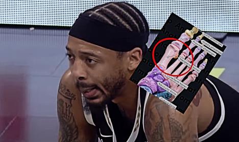 Karlik Džons povreda