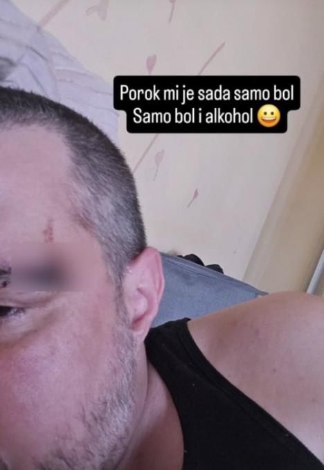 Bojan Tomović zadobio povredu glave