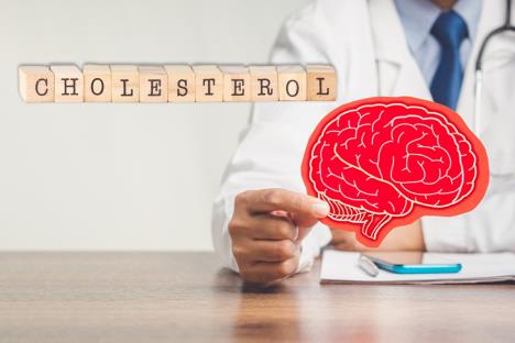 lekar u belom antilu drzi skicu ljudskog mozga u crvenoj boji na papiru pored ispisa holesterol