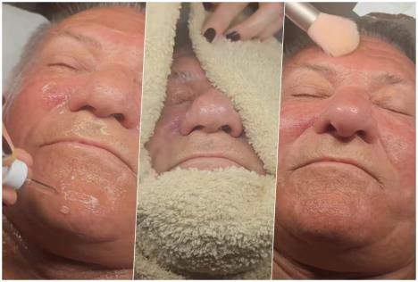 miloš bojanić  anti-ejdž tretman