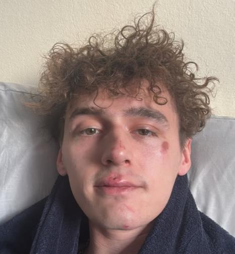 Kameron Kol pretučen pobednik Velikog Brata