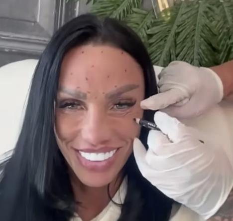 Kejti Prajs botoks izbočine