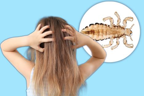 Devojčica se češe po kosi jer ima vaške