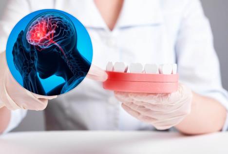 maketa upaljenih desni/hologramski prikaz bola u mozgu