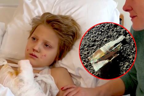 bomba dečaku raznela ruku na ulici