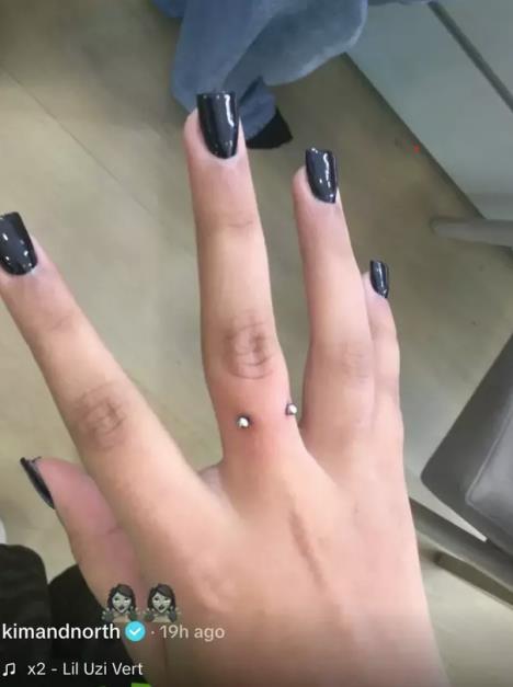 Nort Vest sa novim pirsingom na prstima