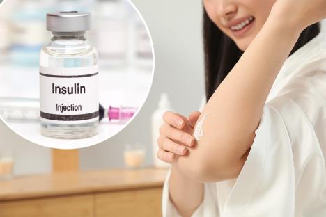 devojka maže kremu na podlakticu/bočica insulina