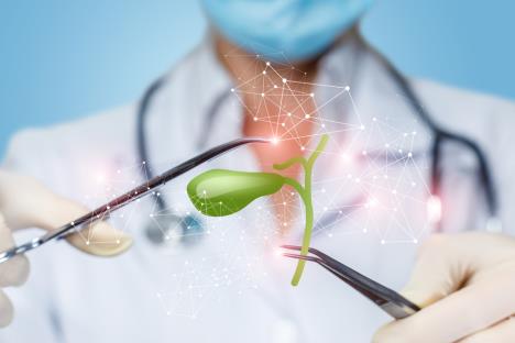 lekar drži pincetom maketu žučne kese i drugom pincetom pokazuje u pravcu nje