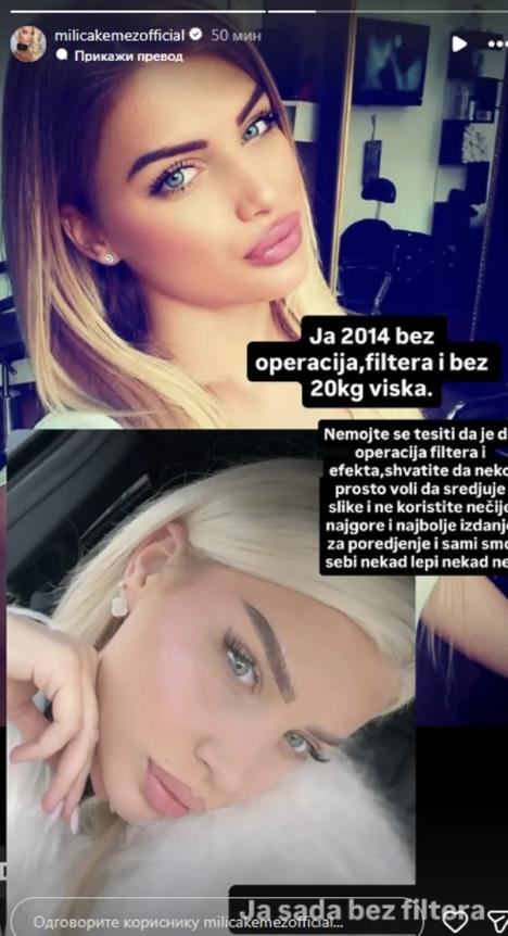 Milica Kemez pre i posle