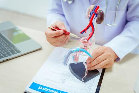 doktor pokazuje model uvećane prosaate