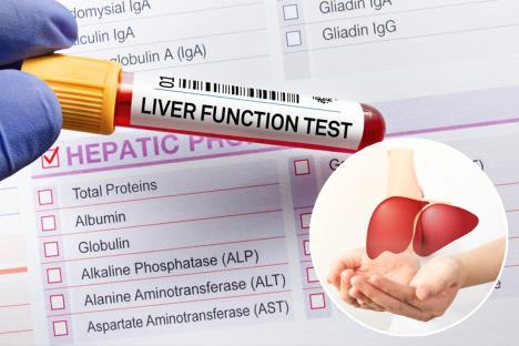 analize krvi za promenu funkcije jetre