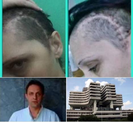 Ružica Stojanović preživela moždani udar