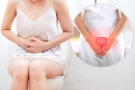 žena sedi na wc šolji i oseća bol u predelu bešike/ ilustracija bešike