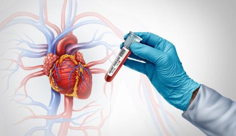 test krvi koji otkriva rizike od srčanih bolesti