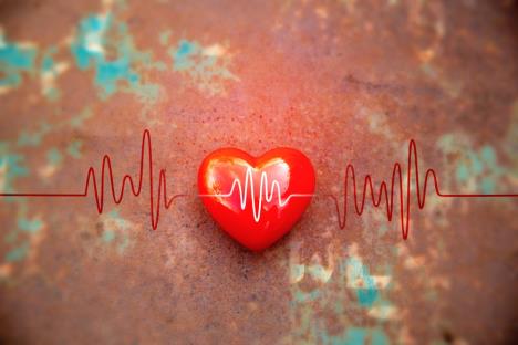 ilustracija srčane aritmije