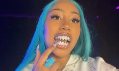 Ćerka Kim Kardašijan, Nort Vest, nosi dijamantske zube