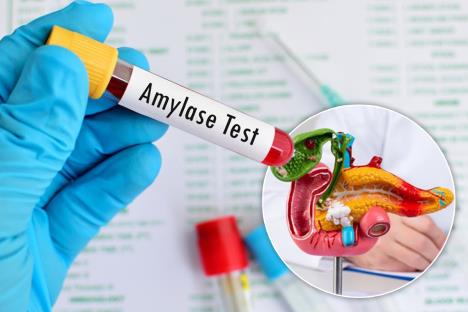 epruveta na kojoj piše amalaza test/pankreas