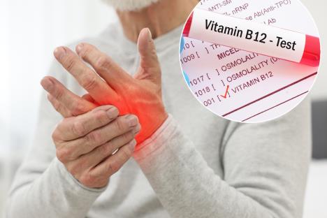 Artritis Vitamin B12