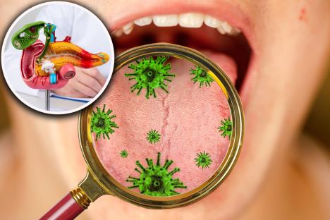 bakterije u ustima/maketa pankreasa