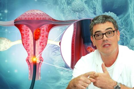 dr Aljoša Mandić/grafički prikaz raka grlića materice