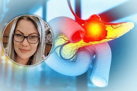 Jasmina Nikolić rak žučnih kanala