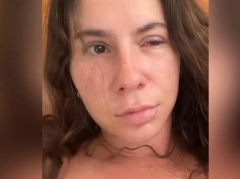 Vivijen Nosovicki - problem sa okom.jpg