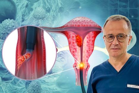 dr Milan Milenković, ginekolog, rak grlića materice 3.jpg