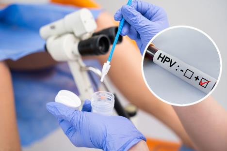 hpv/papa test