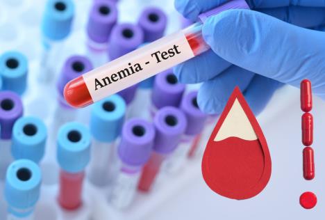 anemija, analiza krvi