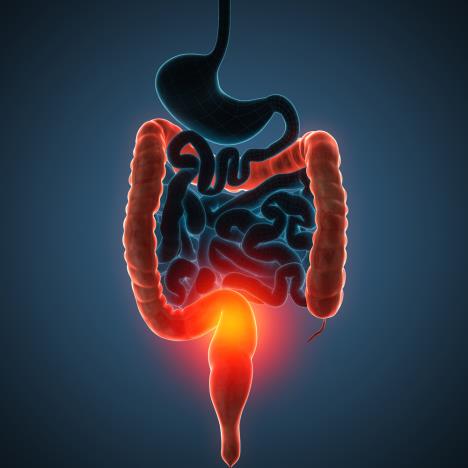 ibd creva