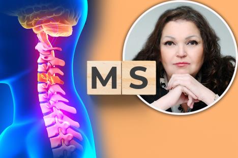 mozak i kičmena moždina/multipla skleroza/dr Gorica Djokic